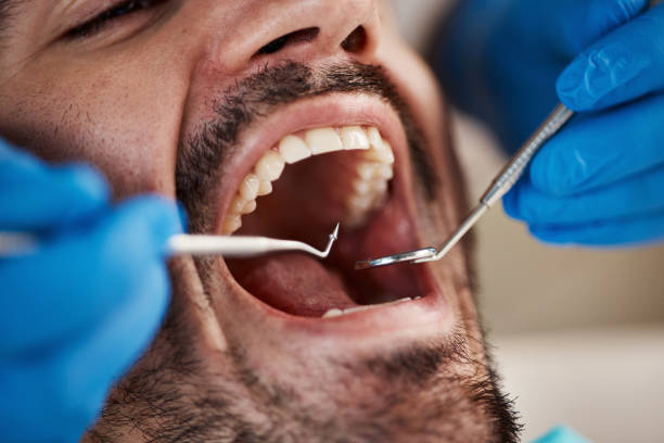 Best Emergency Treatment for Toothache in Eureka, MT